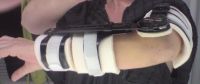 The arm brace